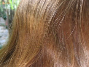 Hair transplant clinic